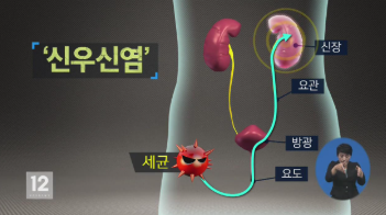  신우신염 입원 하는게 더 좋음 원인 증상