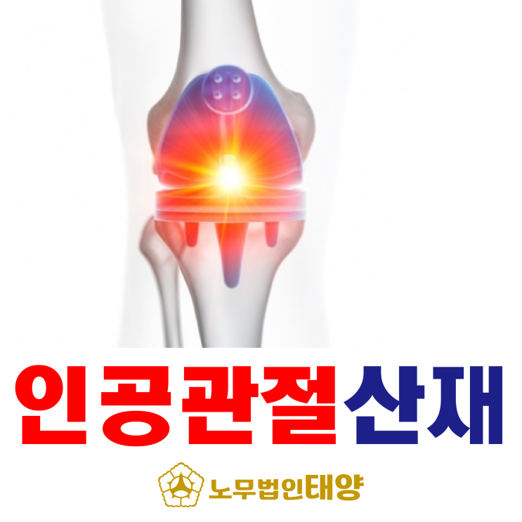  인공관절 수술 후 보상받을 수 있는지 산재신청 무료상담받으세요!