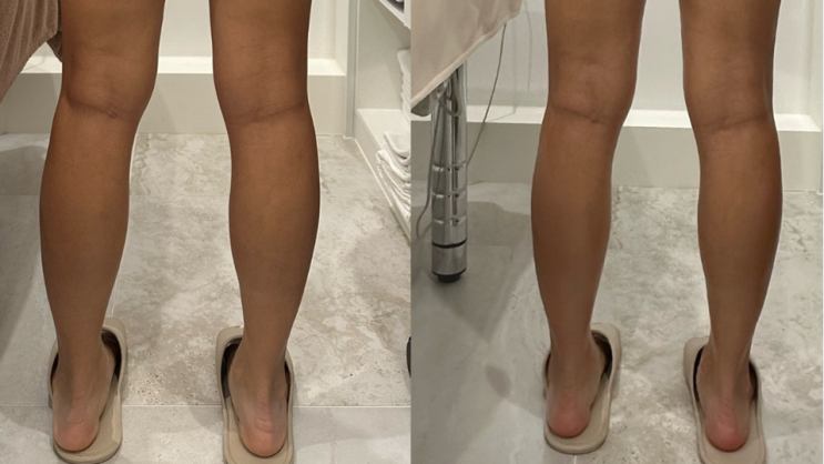  분당피부관리로 피부 개선 에스테틱다리아 분당정자점