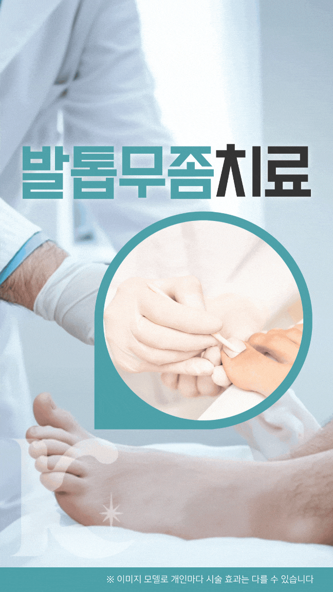  광주무좀발톱 병원에서 치료 받을 수 있습니다