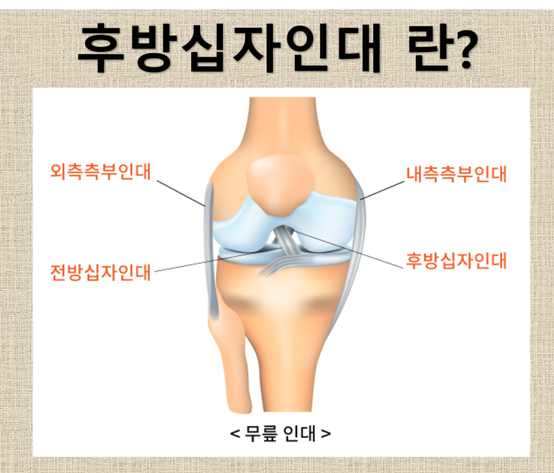 후방십자인대(PCL) 파열에 대해 알아보자.