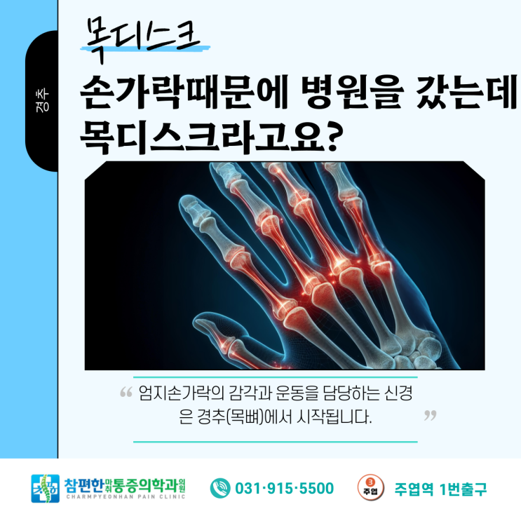  주엽역 정형외과 엄지손가락 저림, 목디스크와의 연관성