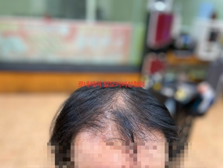  경남양산에서왔다구요? 병원에서머리심기전에 내머리카락으로 펌한번 하고싶어요/ 사상구르네시떼미용실에서말이죠 네. 감사합니다 [경남경북남해거제김해대구대전전남전북충남충북경기서울강원]