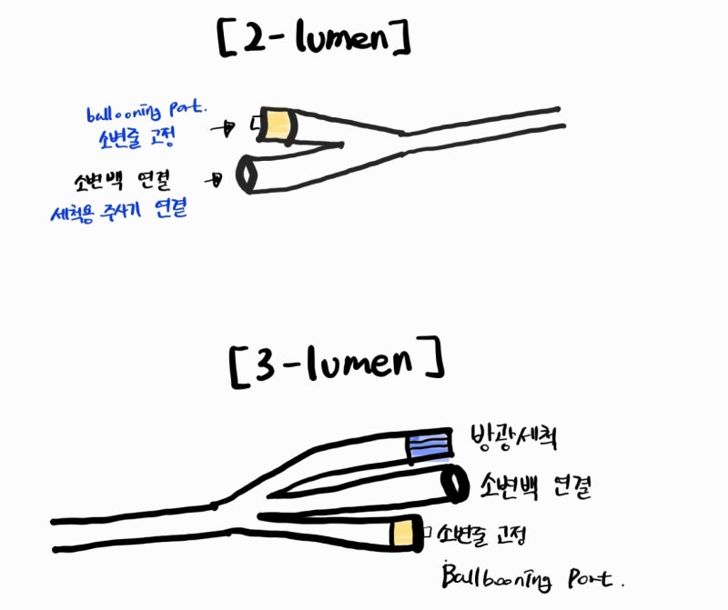 유치도뇨 종류와 방광세척 방법