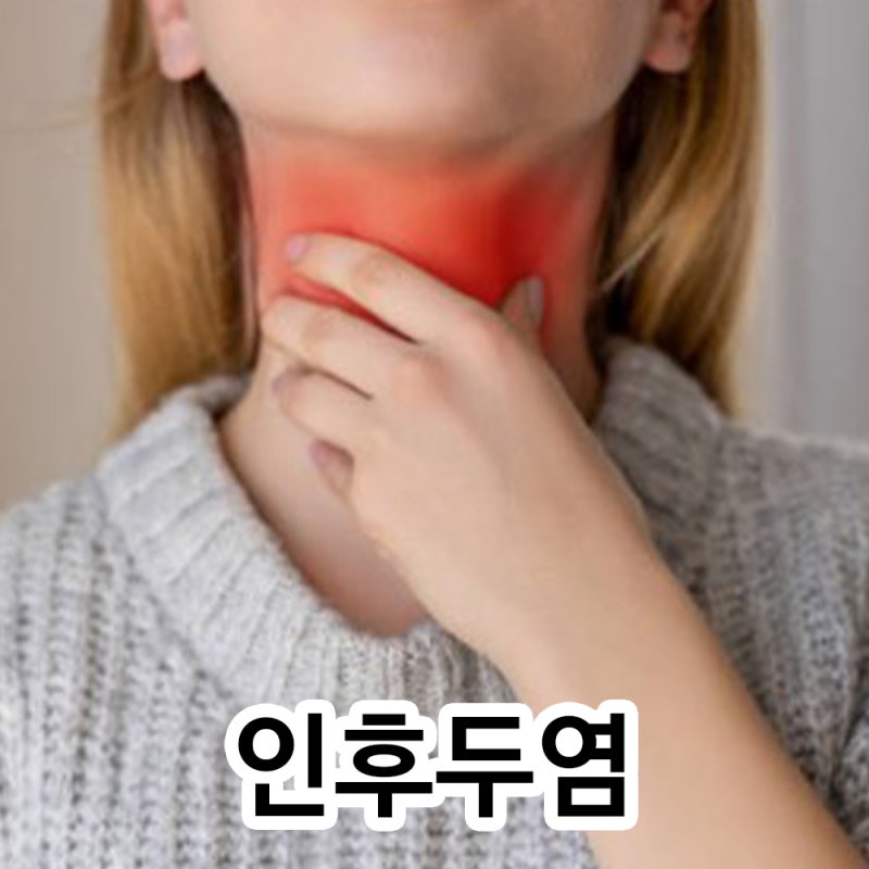 급성 인후두염의 모든 것 A to Z, 초기증상 전염 원인 항생제 치료 예방법