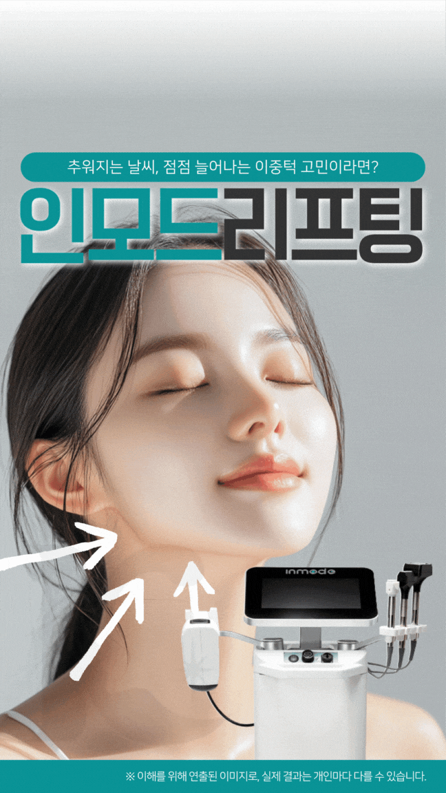  광주인모드리프팅 수완지구에서 FX 포인트 알아보기