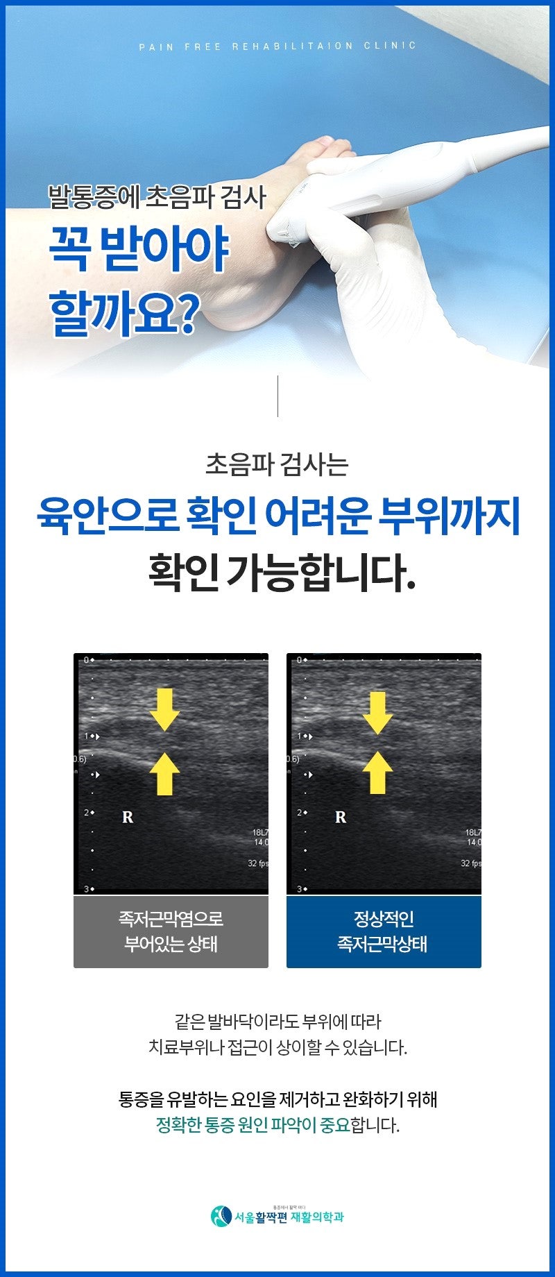 발 통증 치료는 어떻게 하면 좋을까요? — 본문 그림