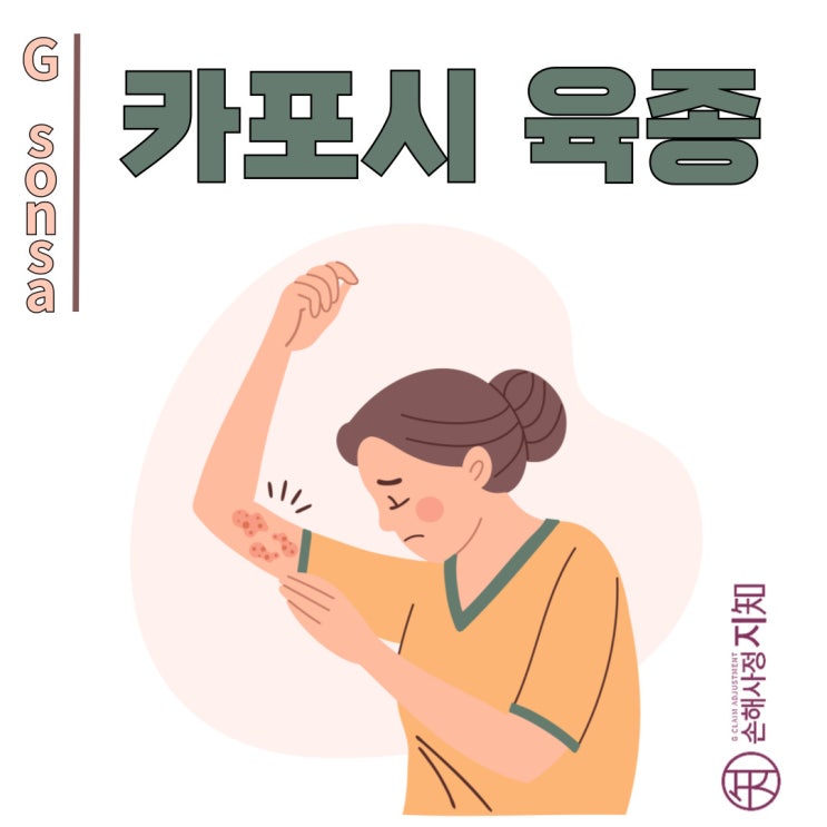  카포시 육종, "보라색 멍 같은 혹이 자꾸 커져요." 혈관에서 시작되는 특별한 종양 - [피부암, 6부]