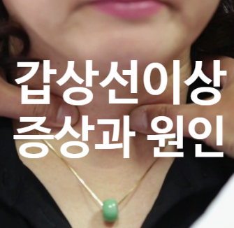  요오드 부족 증상 총정리 - 갑상선 이상, 만성 피로, 탈모, 체중 증가까지, 살찌는 이유, 다이어트!