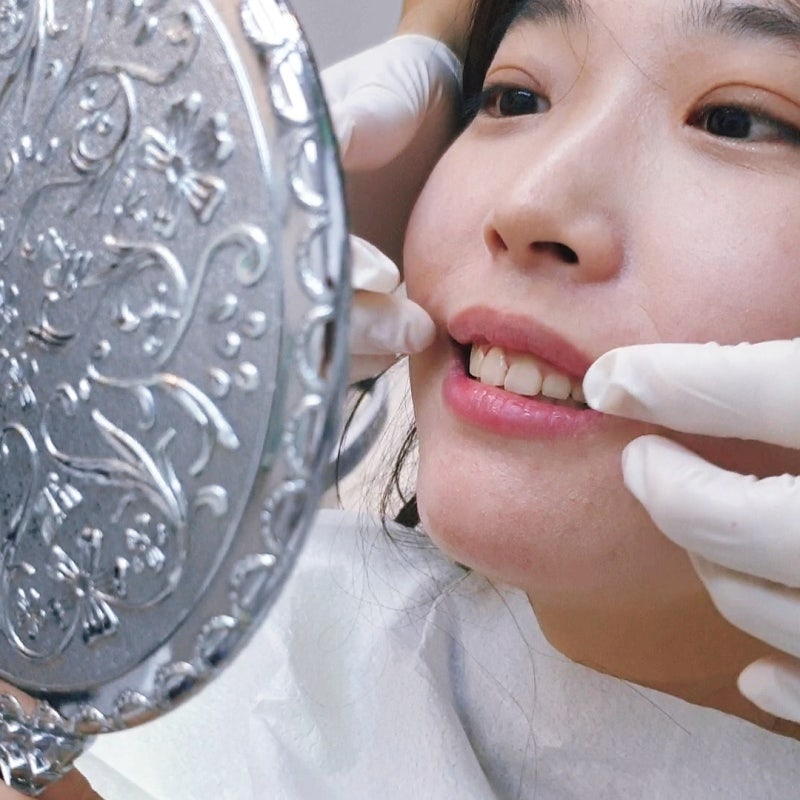 수면 마우스피스 수면용 나이트가드 `이 3가지` 없으면 당장 버리세요