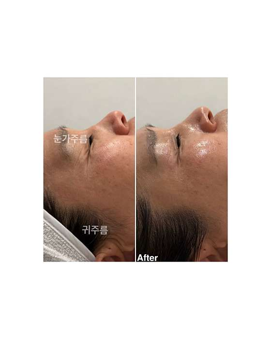 프롬미 사진 2