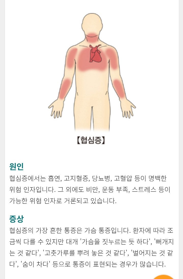 협심증 심장내과 협심증 심장내과