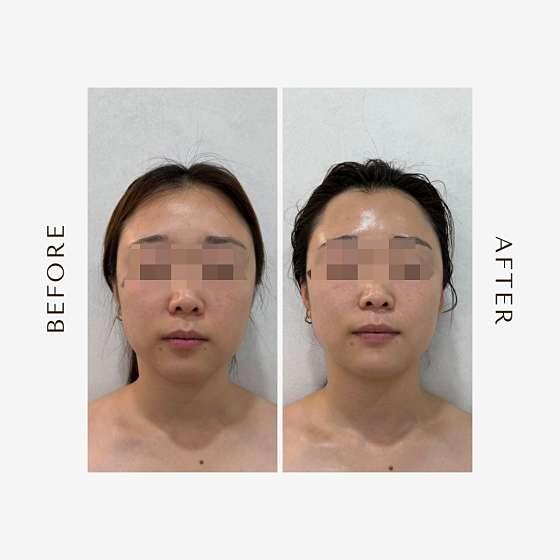 프롬미 사진 3