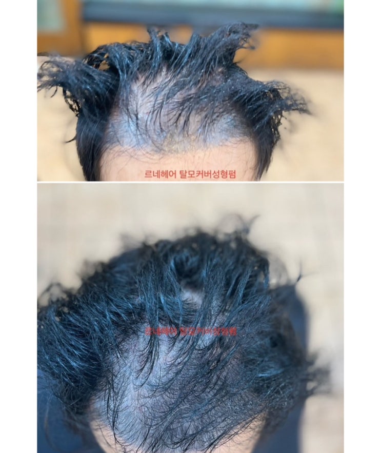  그 남자의머릿빨 그것이 알고싶다 부산탈모토탈케어원스톱 미용실사상르네시떼6층미장원추천헤어샵/ 광안수영망미동래연산연제명륜동래남천용호센텀대연명륜사직초읍명지김해화며영도사하남포초량감천녹산