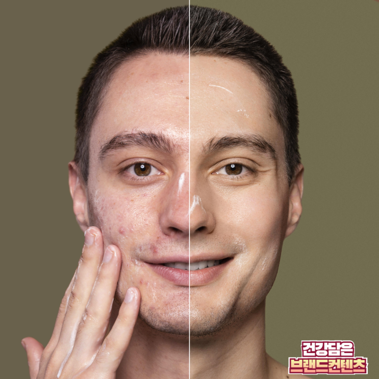  모공줄이는법! 늘어난 모공, 확실하게 줄이는 핵심 방법