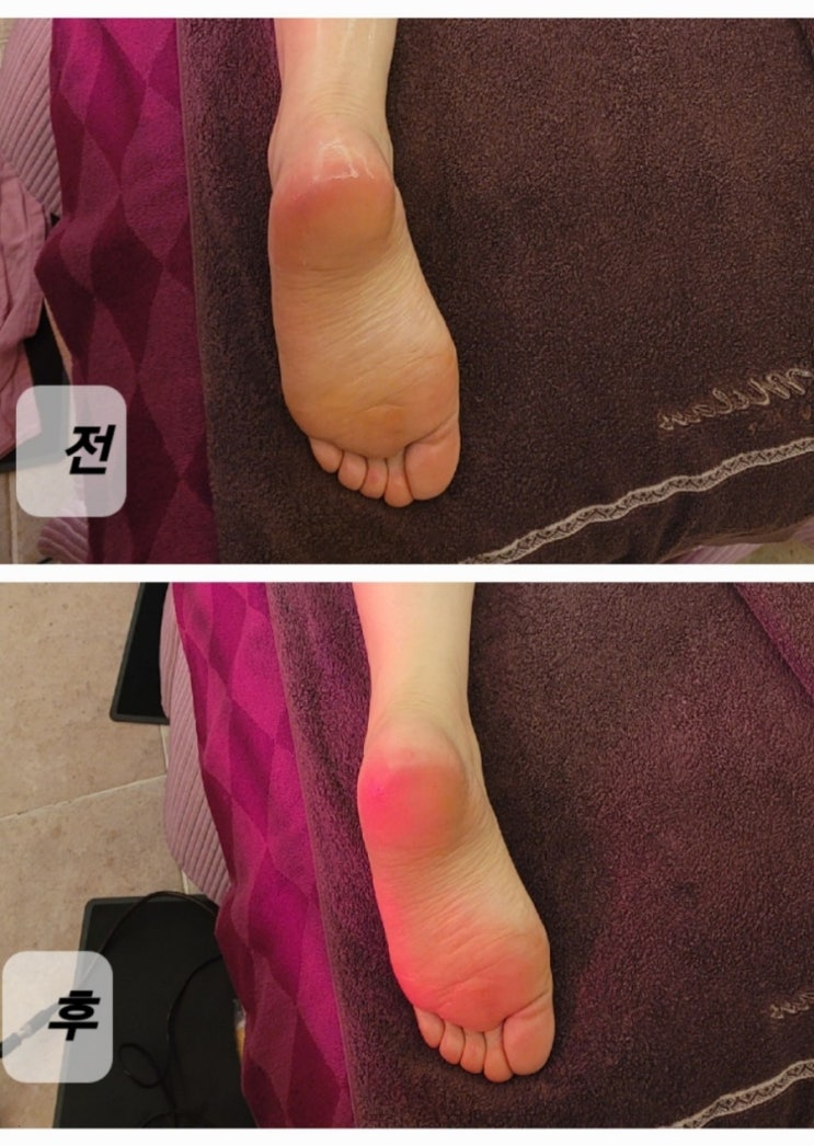  [진해]하체 부종관리 잘하는 진해에스테틱 'THE고운스킨케어'