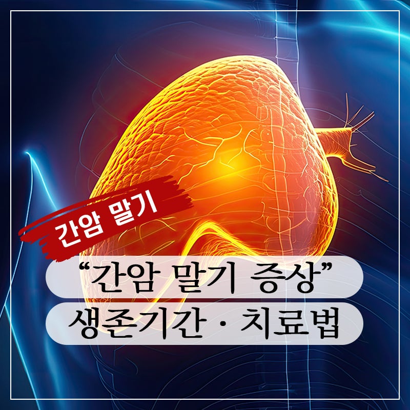 간암 말기 증상ㆍ생존기간ㆍ치료 방법
