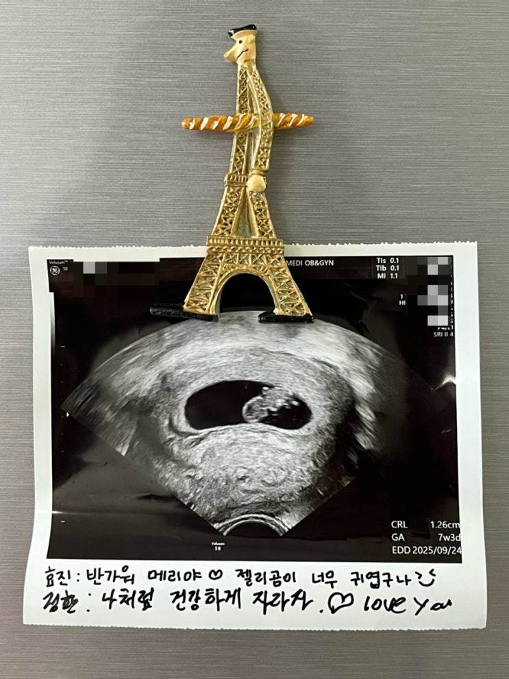 임신 4주차 ~ 6주차 기록 _ 입덧과 먹덧