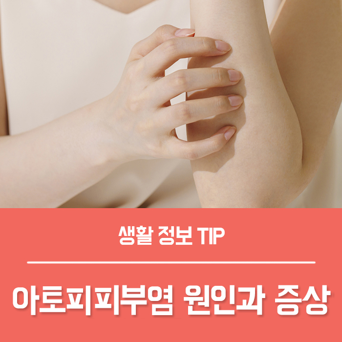  아토피피부염 증상 알아보고 새로고침!