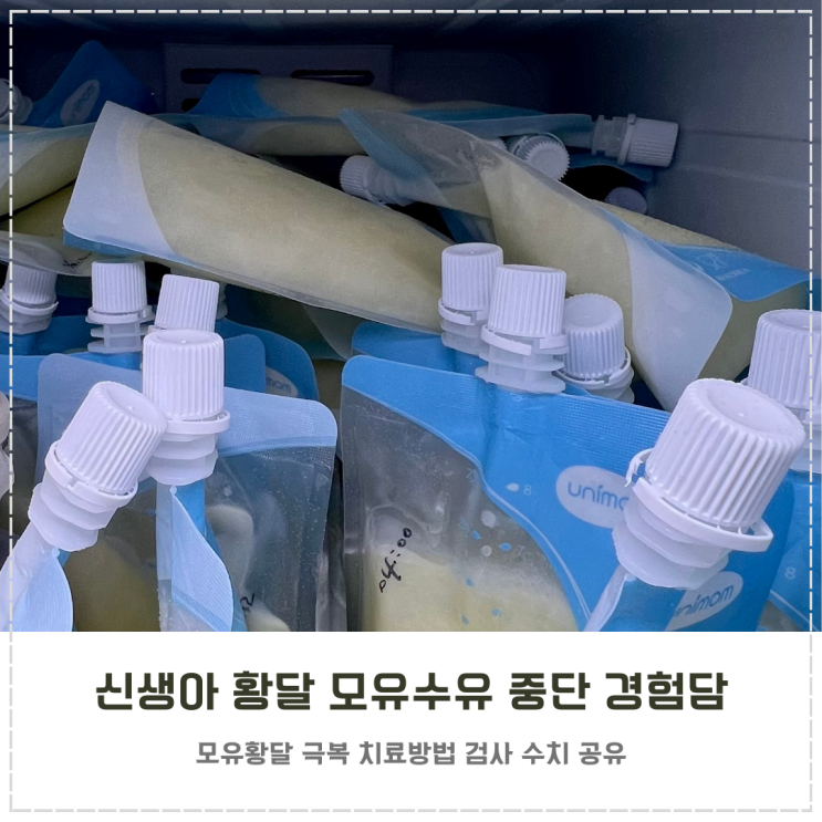  신생아 황달 극복기 모유수유 중단 치료과정과 수치 변화 기록