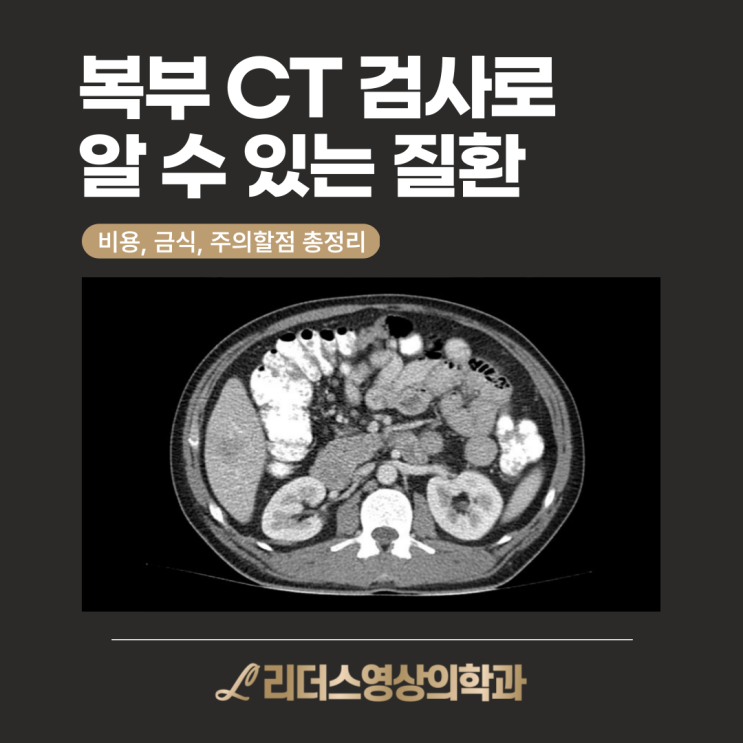  복부 CT로 알 수 있는 질환 : 검사 비용, 금식, 주의사항 총정리