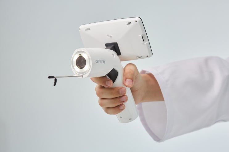  자궁경부확대촬영술(Cervical Colposcopy)이란 무엇일까?