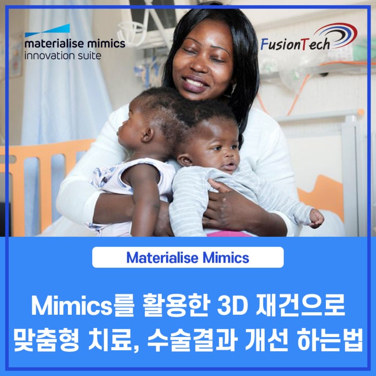  [Materialise S/W] Mimics를 활용한 3D 재건으로 환자 맞춤형 치료 및 수술결과 개선 하는법