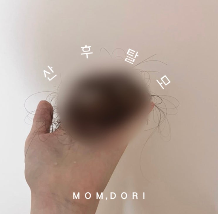  출산 후 몸 변화_산후탈모, 너 언제까지 빠질 거야? 극복기와 관리법 공유 인생 앰풀 추천!