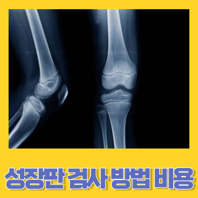 성장판 검사 검사방법 비용 및 시기 주의사항