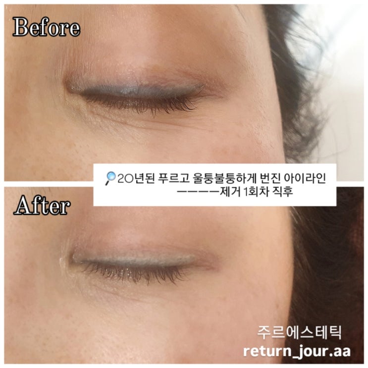  ️20년된 아이라인?️부산 주르 에스테틱&아카데미
