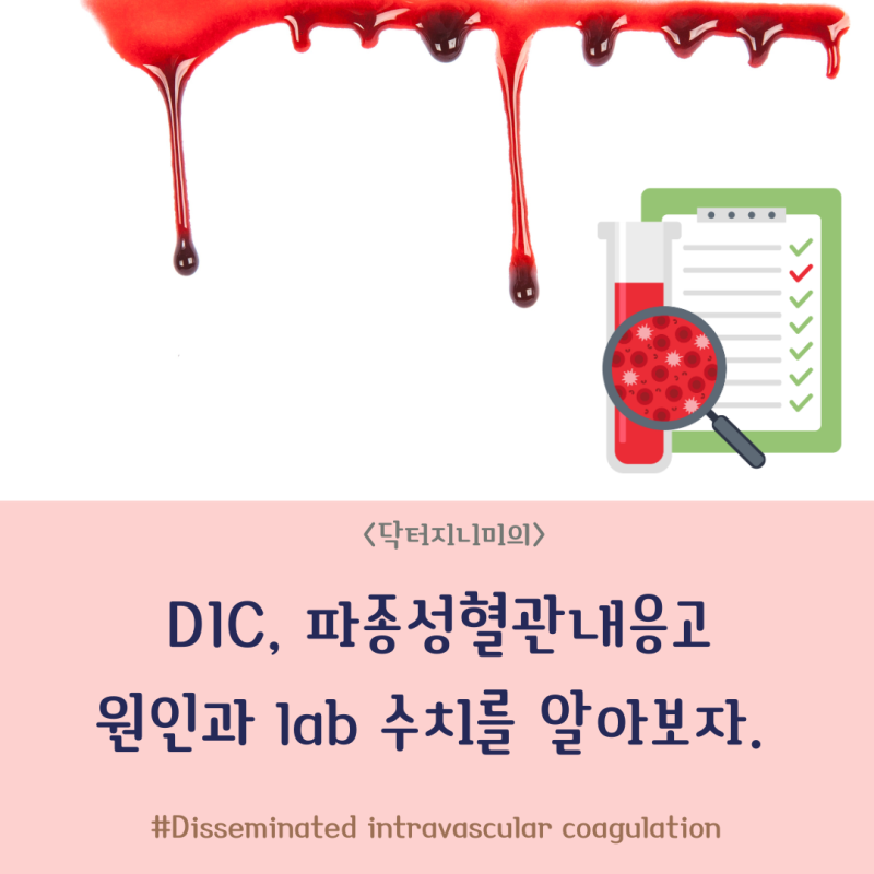 DIC (disseminated intravascular coagulation 파종성혈관내 응고) 이 생기는 원인과 lab 수치 ...