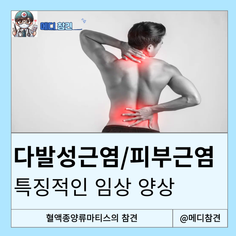 피부근염 Dermatomyositis 다발성근염 Polymyositis