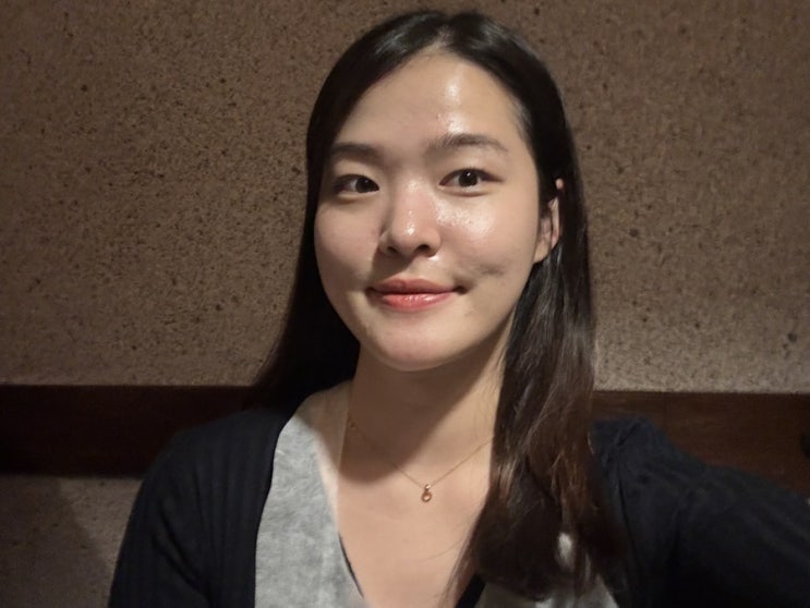  명동역 엑소좀, 셀엑소좀 블랙라벨 여드름 시술 후기