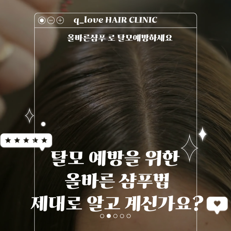  탈모 예방을 위한 올바른 샴푸법