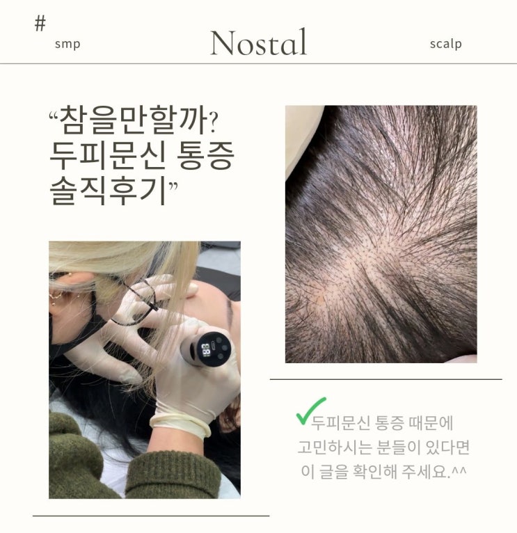  두피문신, 통증이 걱정이라면?