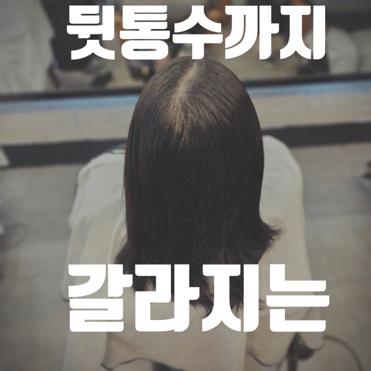  뒷통수까지 갈라지는 가르마? 40대 여성의 모류교정 링거펌 후기