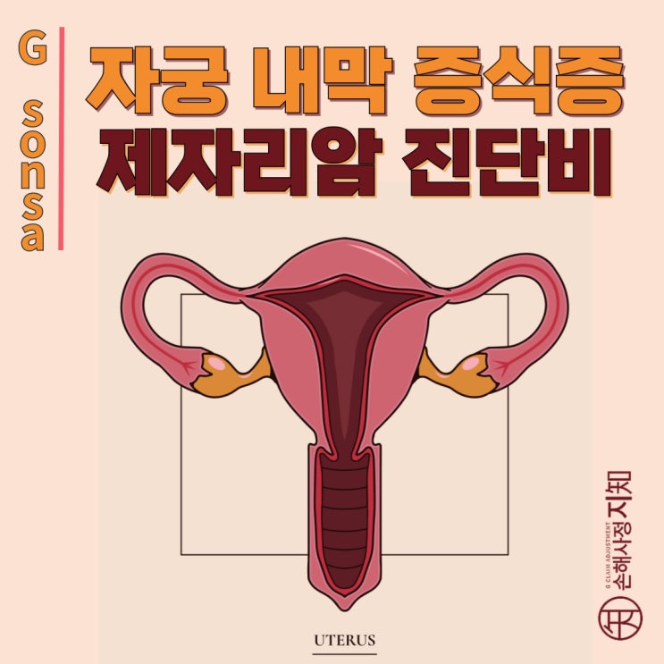  자궁내막증식증 (N85), 제자리암 보험금 받을 수 있을까? 거절당한 사례 해결법! - [엄마의 질병, 1부]