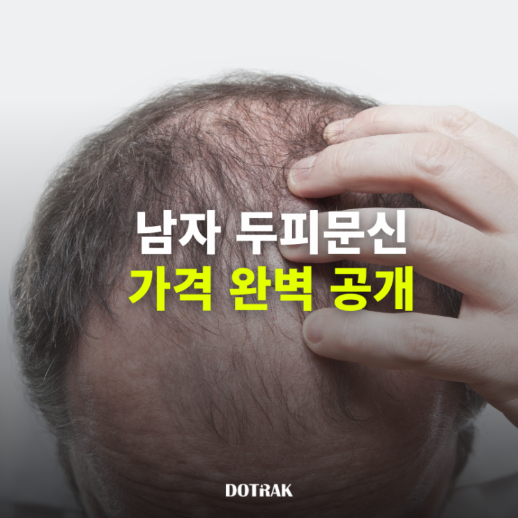  남자 두피문신 가격 완벽 공개