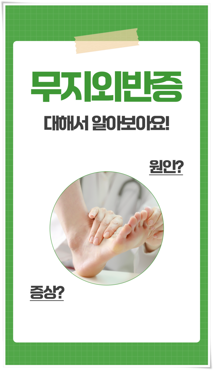  무지외반증 원인과 증상에 대해 알아보아요
