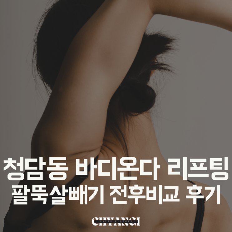  청담동 바디온다리프팅으로 팔뚝살빼기 내돈내산 전후비교 통증 가격 후기