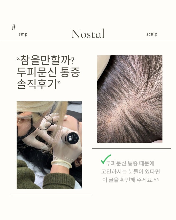  대전SMP두피문신 아플까 봐 걱정이세요?