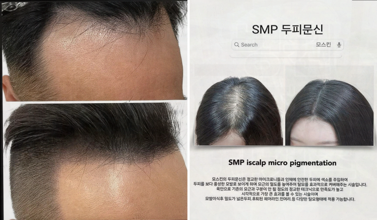  부산진구, 접근성 좋은 모스킨에서의 특별한 뷰티 경험