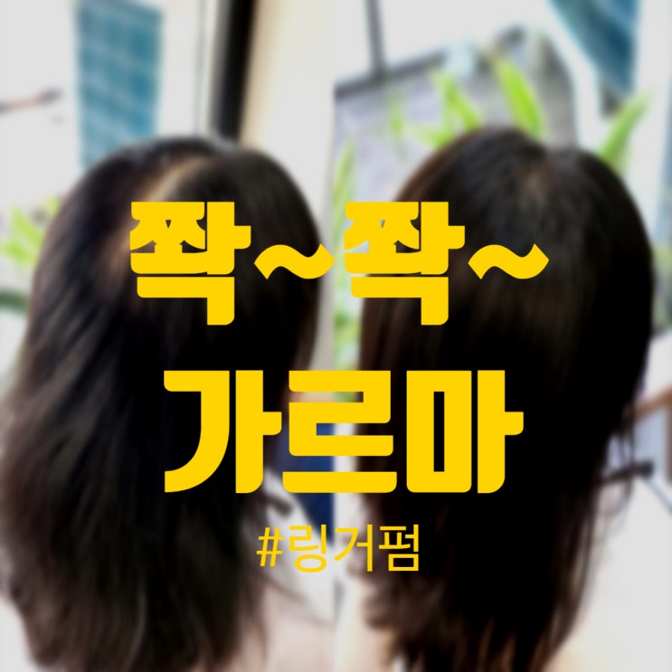  쫙쫙 벌어지는 가르마, 링거펌으로 자연스럽게 해결!