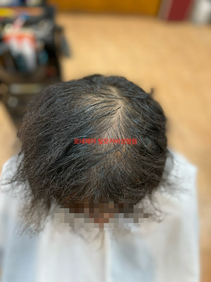  M자탈모정수리남자탈모 ㅁㅂㅇㅅ을해도휑하다 드디어르네시떼미용실을만나 굿잡!/ 사상감전괘법덕포덕천화명대저가야영도개금주례학장구덕남포남천대연수영망미토곡안락동래연제기장정관용호센텀망미감천