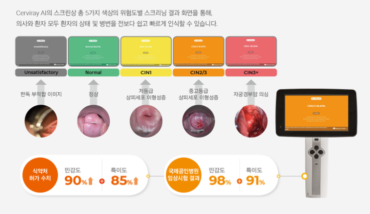  자궁경부암 검진의 중요성과 VIA 검진, 그리고 Cerviray AI의 역할