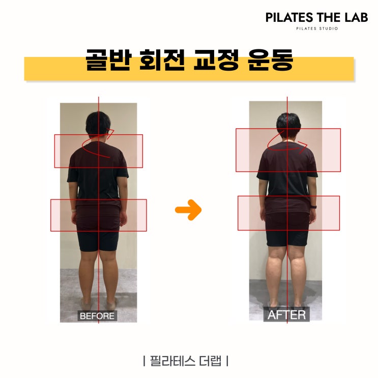  목동 필라테스 골반 회전 교정, 허리 통증 완화까지! 비포&애프터 비교 분석