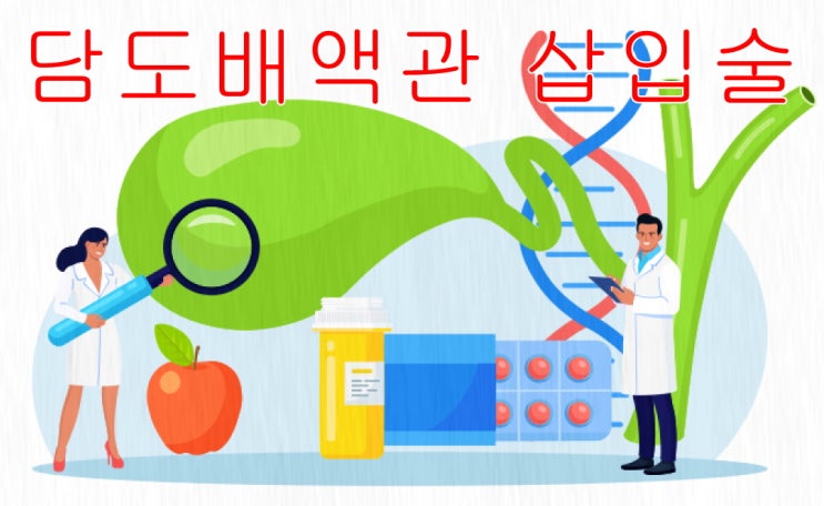  담도배액관 삽입술이 암수술에 해당하는지 여부