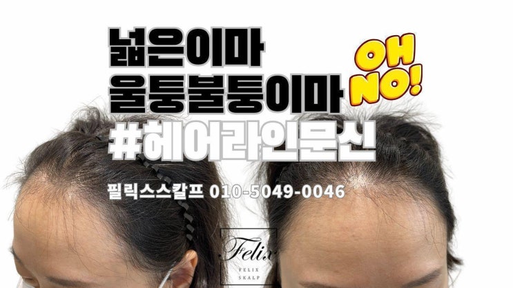  장기동연예인헤어라인문신 잘하는곳