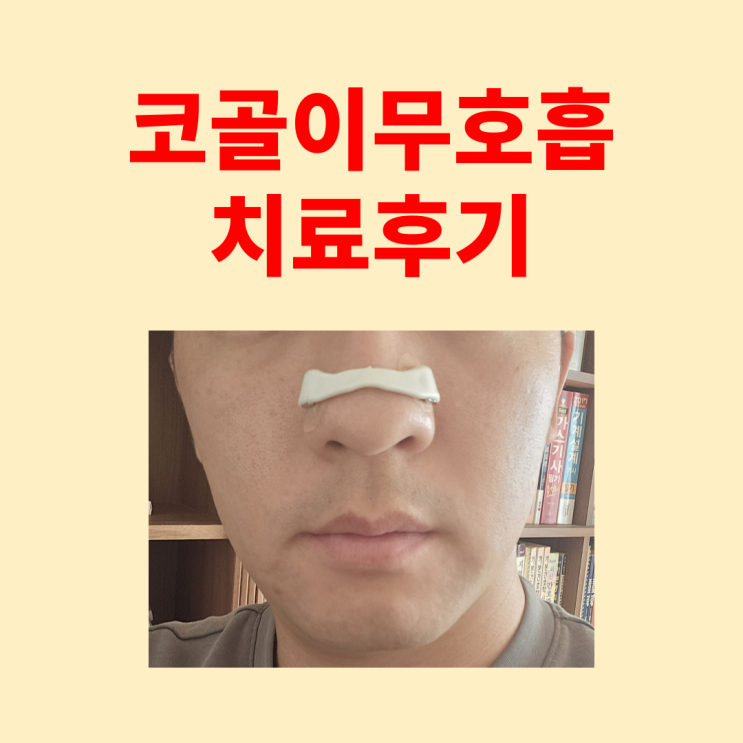  코골이무호흡 치료 후기