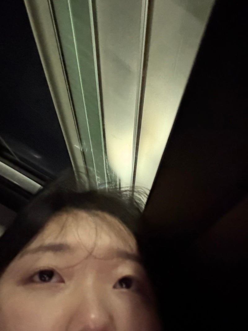 미레나 시술 일주일차 후기 통증, 부작용, 보험처리까지